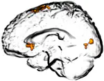 Highlighted Data Set: An fMRI Study of the Drawing Effect